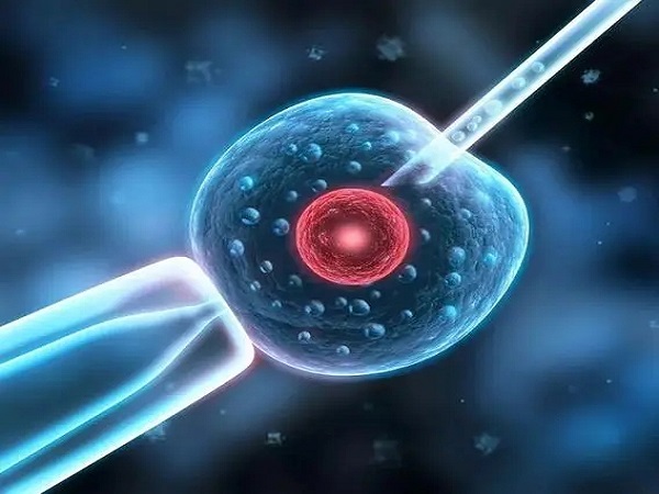 胚胎移植是试管的关键步骤