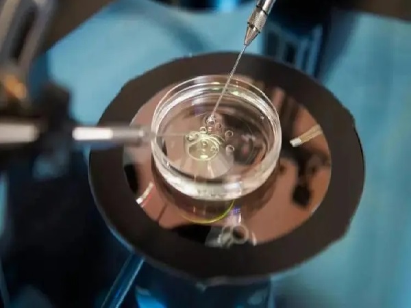囊胚移植前需要进行基因和染色体筛查