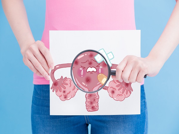 子宫腺肌症是比较常见的妇科疾病