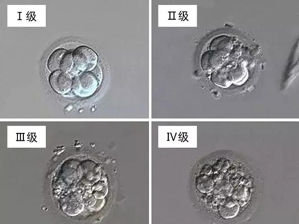 受精卵根据细胞数量、大小分为4个等级