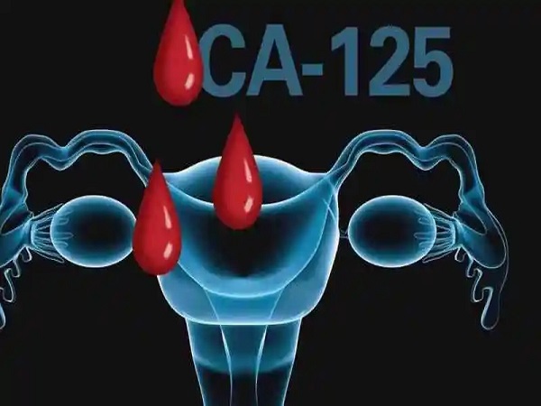 ca125高会影响胚胎着床