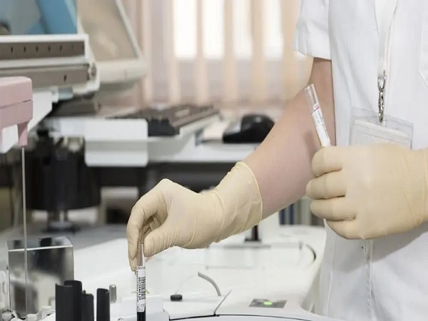 试管胚胎送检要30天可能是筛查的胚胎数量多导致的