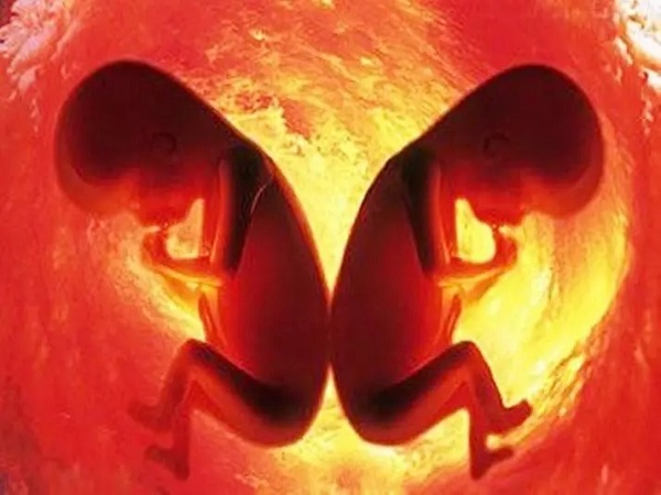 鲜胚移植hcg3000多可能怀上了双胞胎