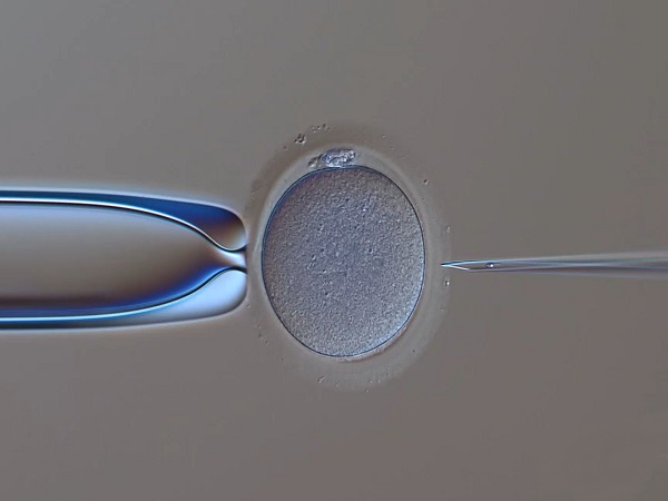 内膜16mm需要取消胚胎移植