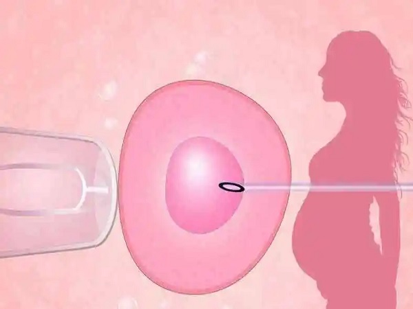 胚胎移植后孕吐症状消失不一定是失败了