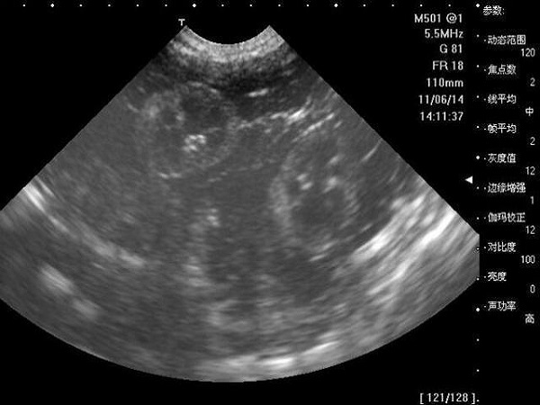 ac是胎儿的肚子一周的数据