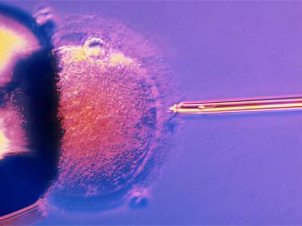 移植后女性出现腹痛可能是因为母体排斥胚胎