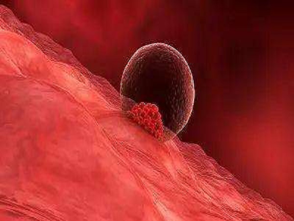 胚胎着床后出血是子宫内膜厚所导致的