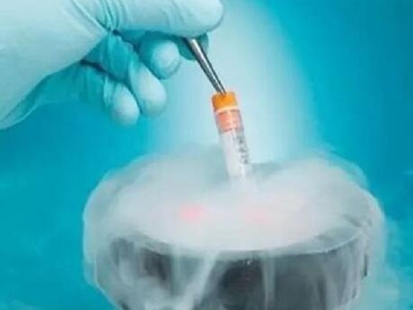 试管冷冻胚胎的个数根据患者具体情况决定