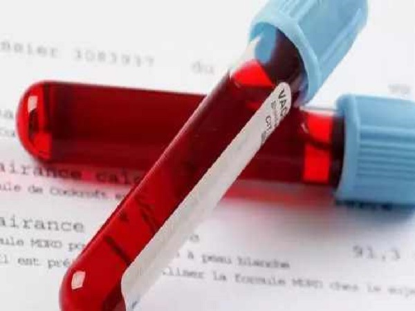 试管移植前抗凝血检查需要抽取静脉血管血液进行检测