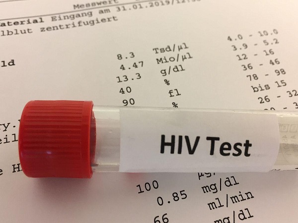 hiv感染就是患上艾滋病