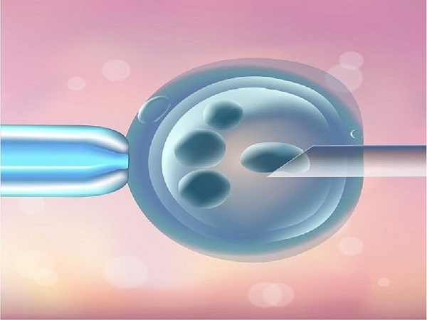 胚胎移植是试管婴儿中的关键环节
