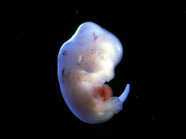 试管婴儿胚胎的生长发育与自然受孕的没什么不同