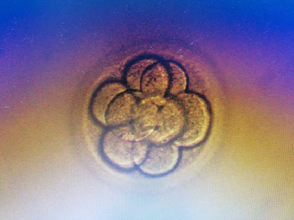 0pn囊胚是属于异常胚胎