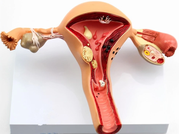 试管囊胚移植后检查发现子宫长瘤建议先做一个详细的检查