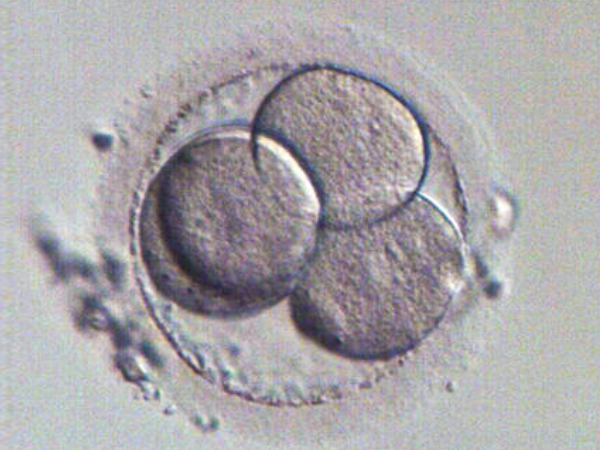 3天4细胞的胚胎不适合养囊
