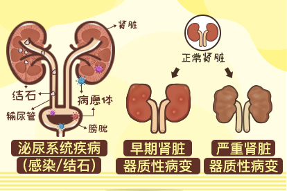 尿液有泡泡是什么原因图片