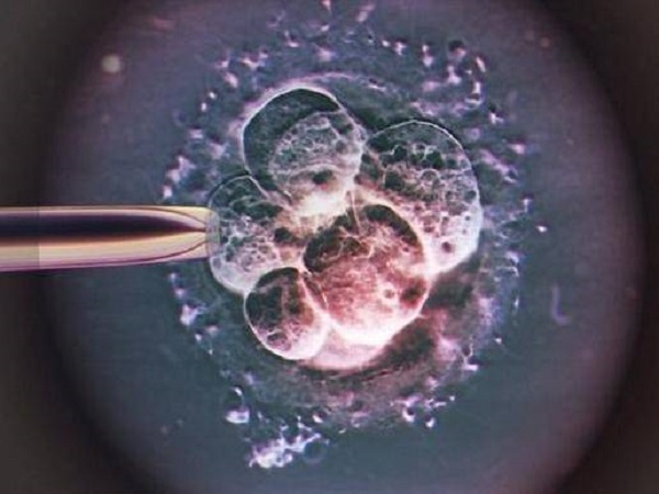 冻胚不需要放入实验室养囊的说法需要看具体情况