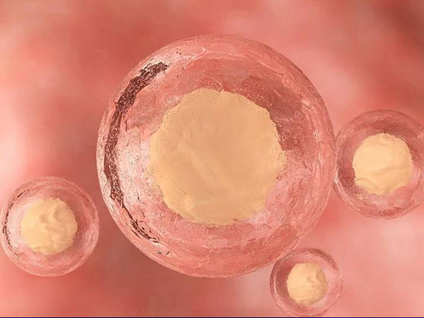 鲜胚移植有生化的概率