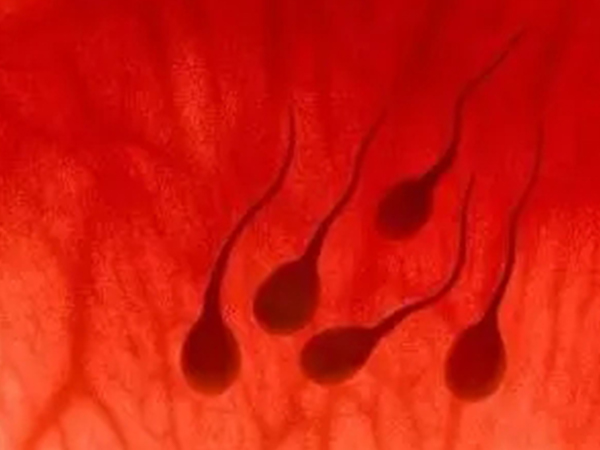 精子是鲜红色一般为血精症