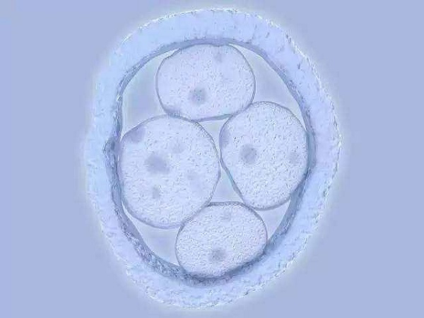 胚胎自身等原因都容易导致移植后出现空囊