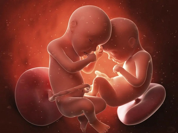龙凤胎每个胎儿的状态不同