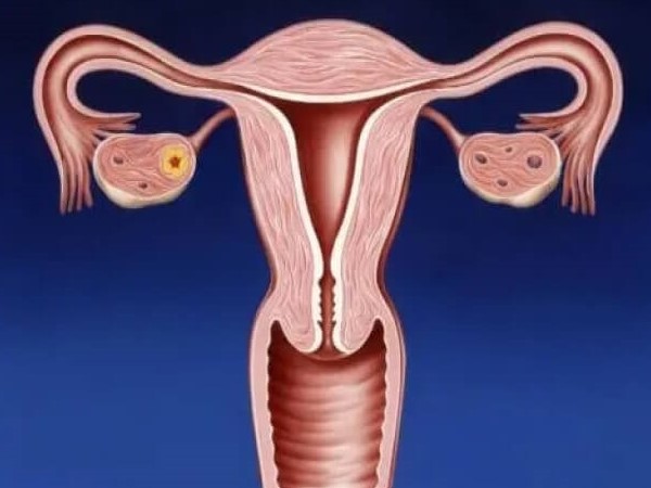 输卵管积水会影响子宫环境