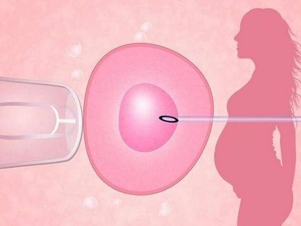 高龄女性做试管婴儿助孕更适合短周期方案