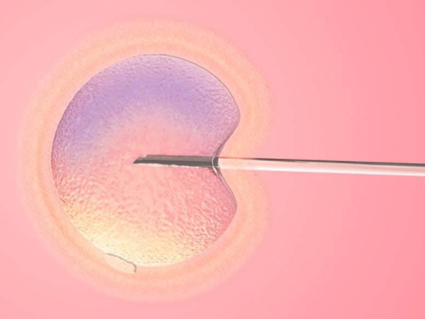 鲜胚移植后患者身体会有反应