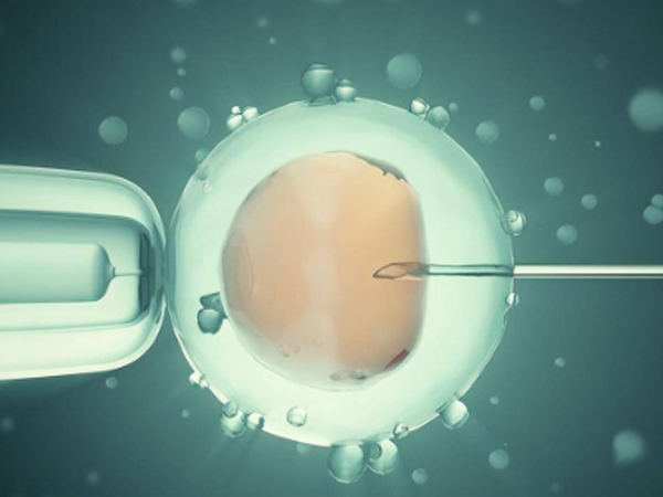 胚胎移植过程非常简单