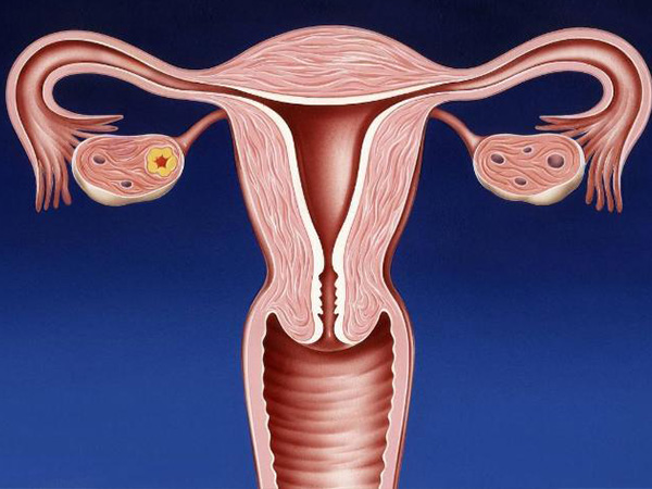 子宫内膜脱落可能会排白色物体