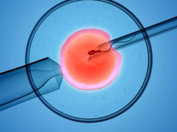 胚胎移植对内膜有要求