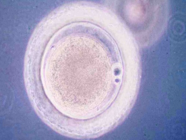 试管胚胎的级别划分标准