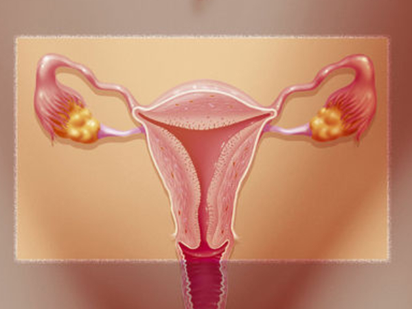 子宫内膜状况会影响试管婴儿