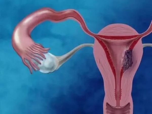 内膜5mm的女性不能移植两个胚胎