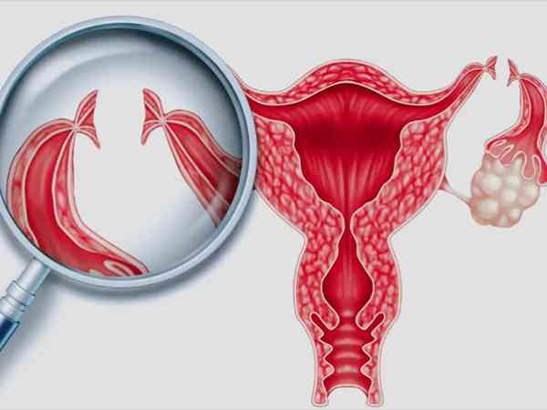 输卵管切除可能会影响生育