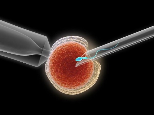 胚胎移植前是否需要子宫埋线因人而异