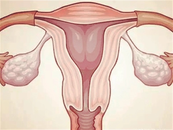 降调28天后子宫内膜还是很厚可以做刮宫手术