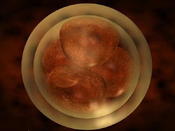 移植两个成功一个另一个胚胎会随机体排出体外