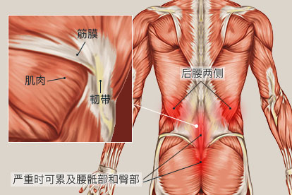 腰肌劳损疼痛的部位