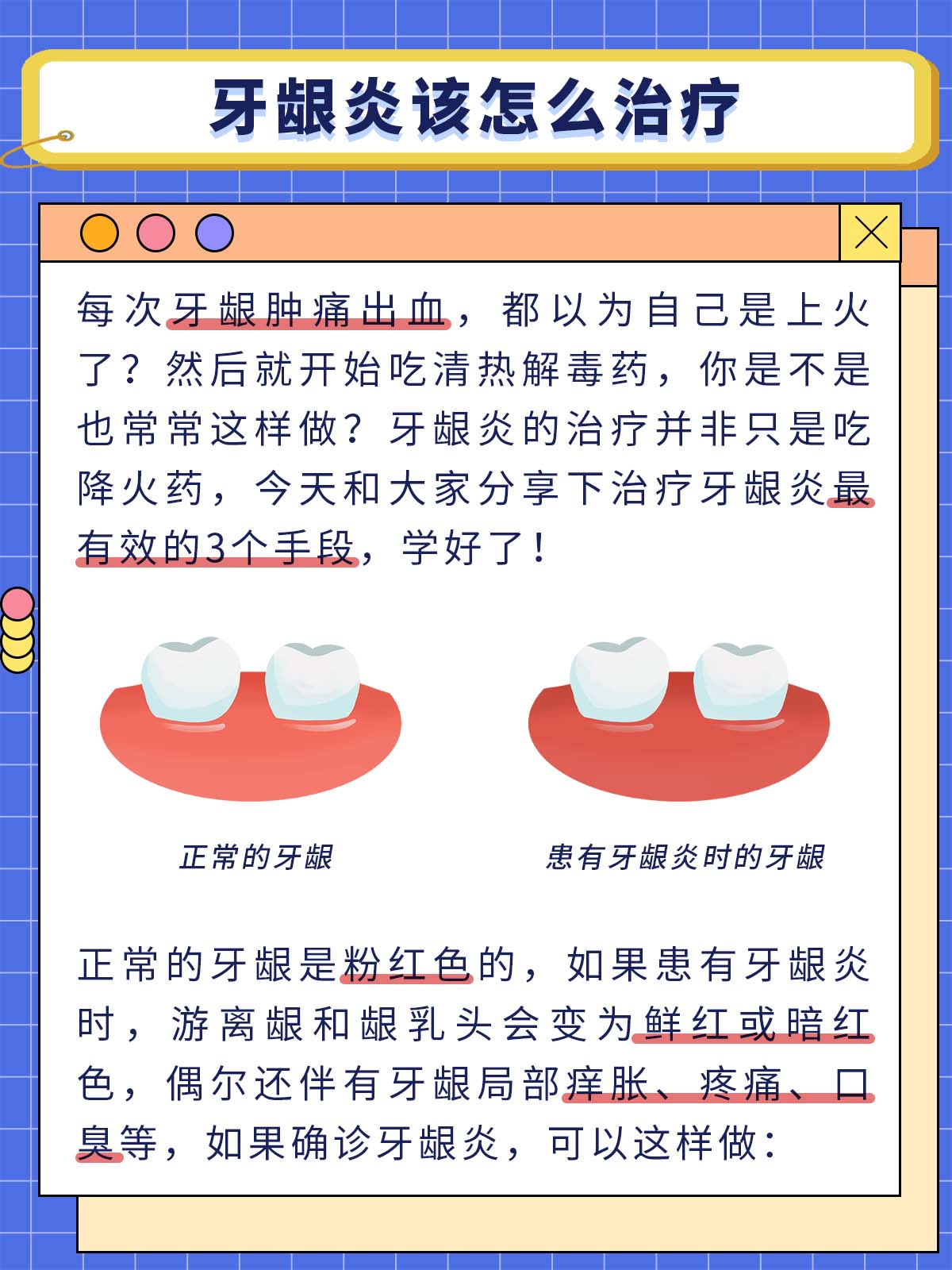 牙龈炎该怎么治疗
