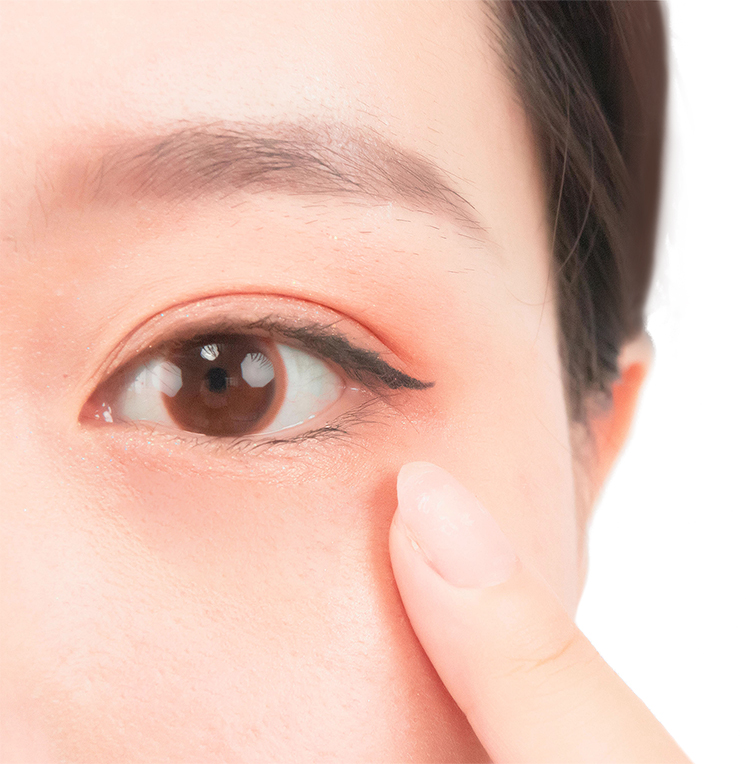 割双眼皮手术后的恢复时间及关键因素