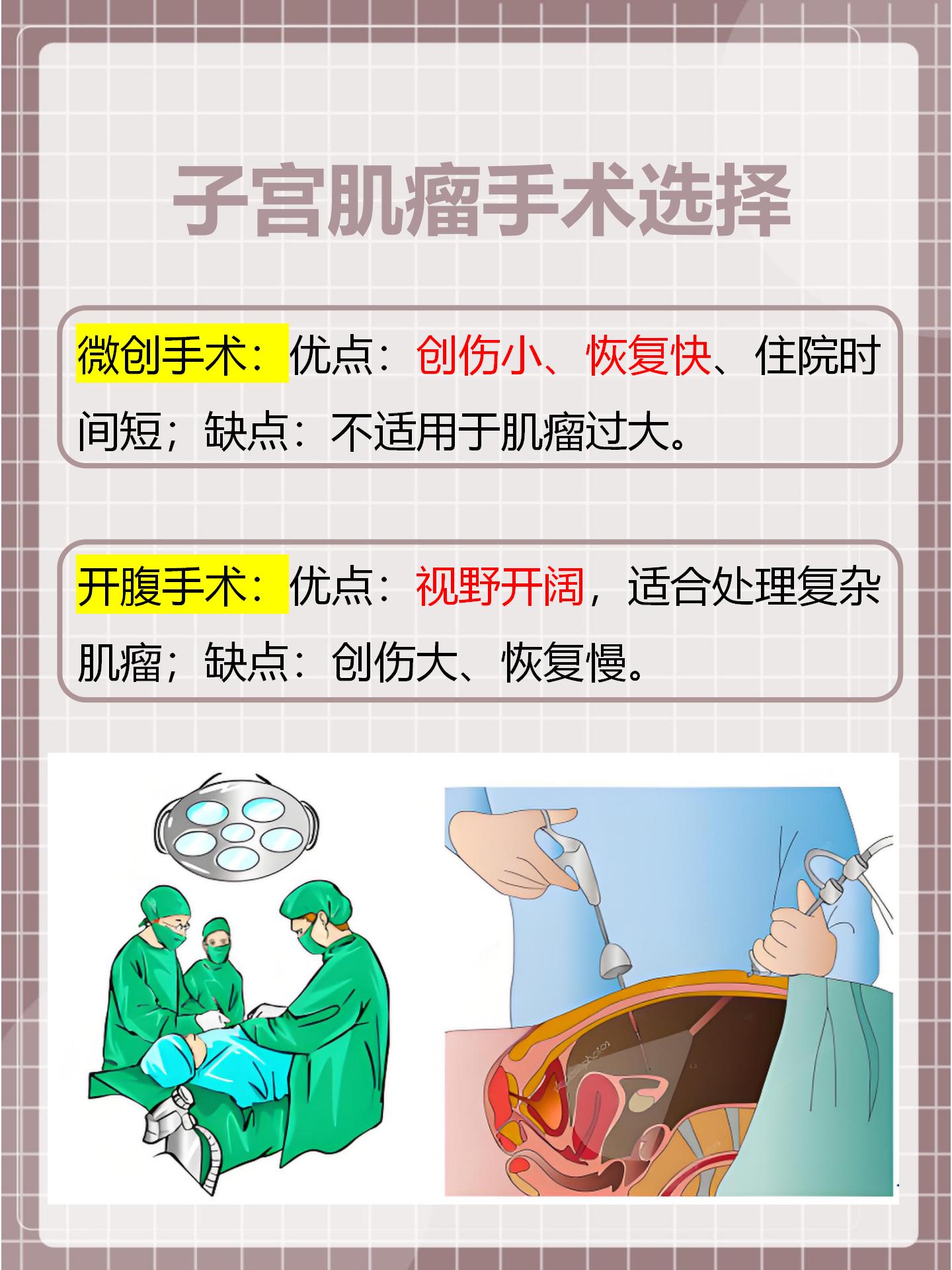 子宫肌瘤手术是微创好还是开腹好？一文看懂！