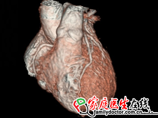 3D Heart软件