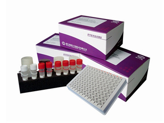 总甲状腺素 (TT4)定量测定试剂盒(化学发光法)