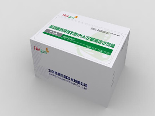总前列腺特异性抗原检测试剂盒(免疫比浊法)