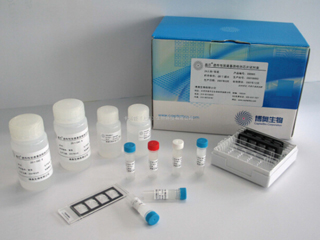 糖类抗原CA19-9定量测定试剂盒(磁微粒化学发光法)