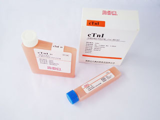 触珠蛋白测定试剂盒(免疫透射比浊终点法)