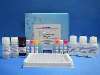 果糖胺(FMN)检测试剂盒(NBT比色法)