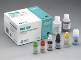 巨细胞病毒(CMV)核酸定量测定试剂盒(荧光PCR法)